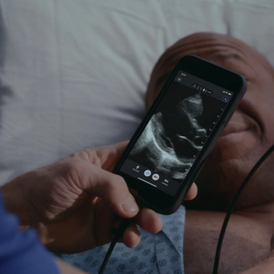 Picture of the Butterfly iQ3 Ultrasound System